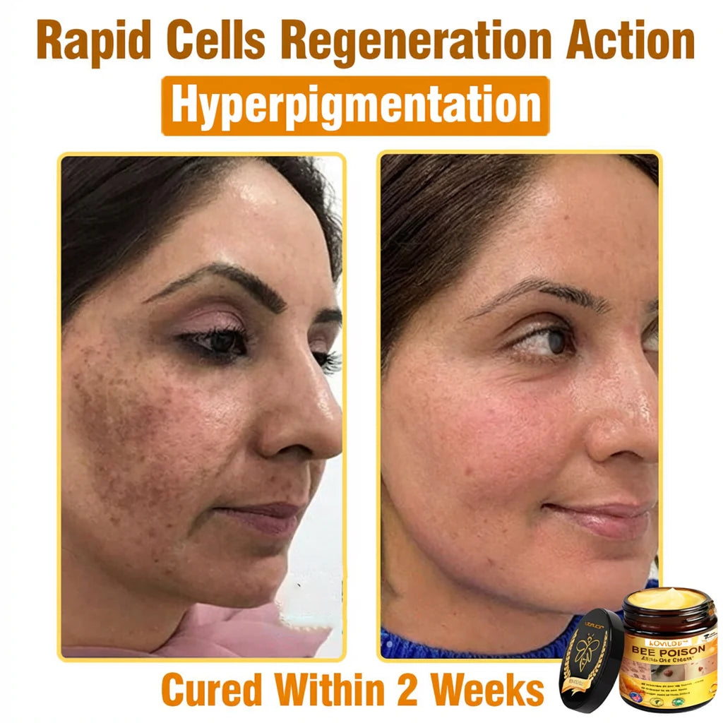 Bee Venom Skin Repair Cream ā Anti-Aging & Acne Solution