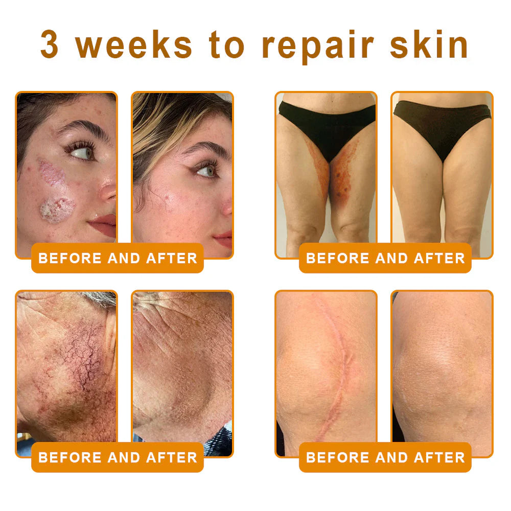 Bee Venom Skin Repair Cream – Anti-Aging & Acne Solution