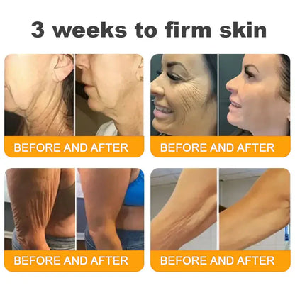 Bee Venom Skin Repair Cream – Anti-Aging & Acne Solution