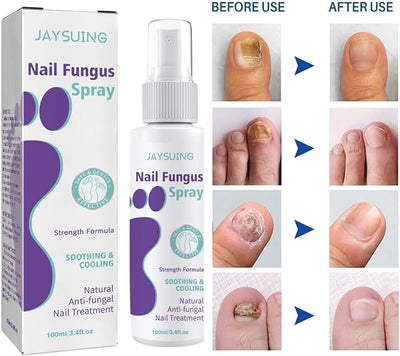 Gentle Nail Fungus Remover Maxum
