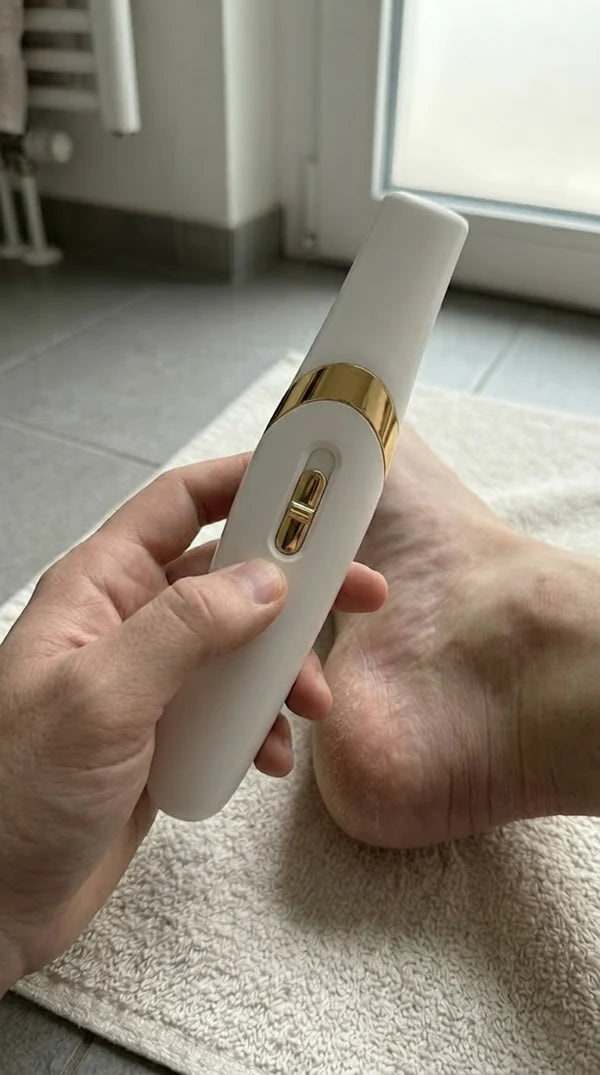SoftStep Callus Remover